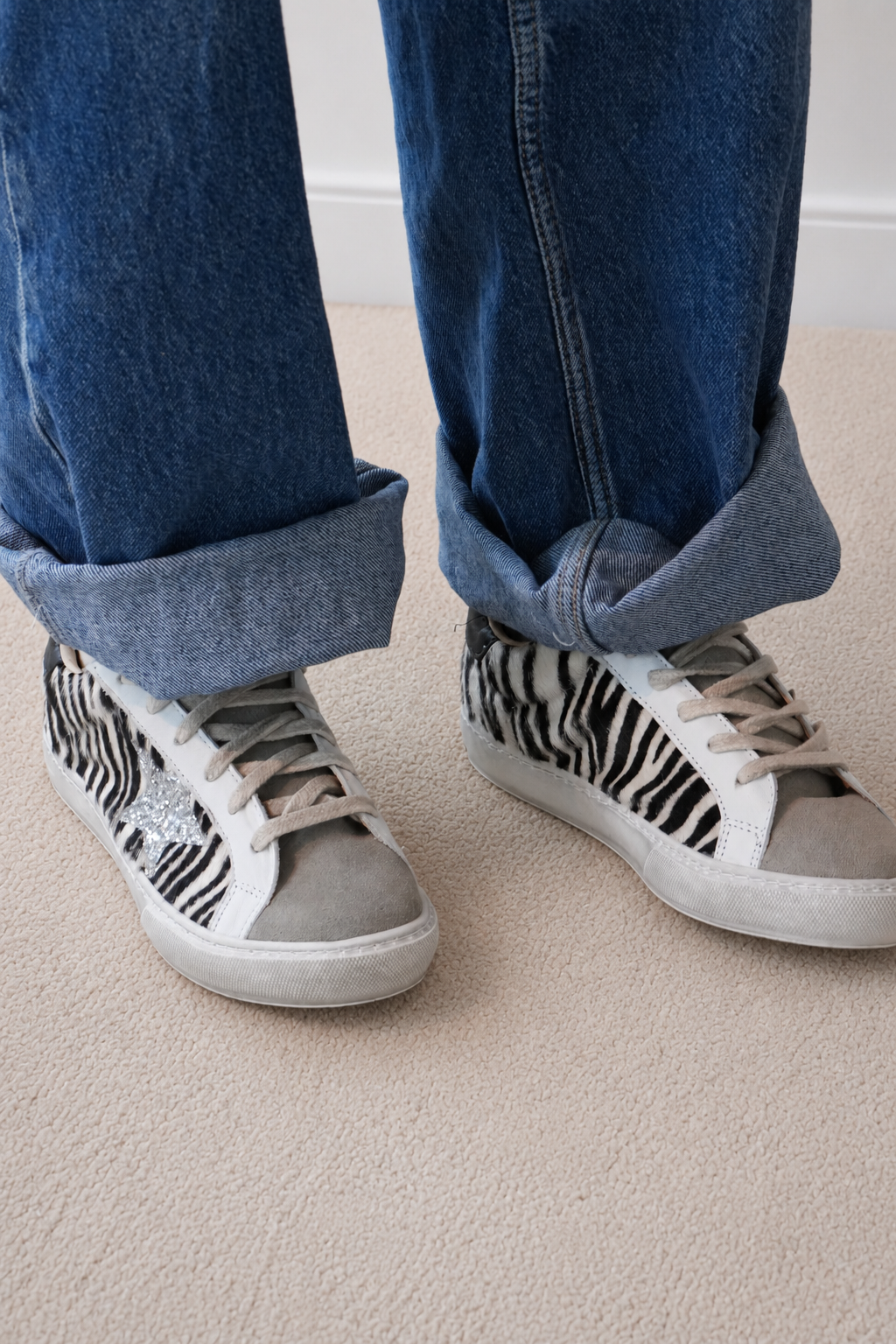 Star pelo zebra