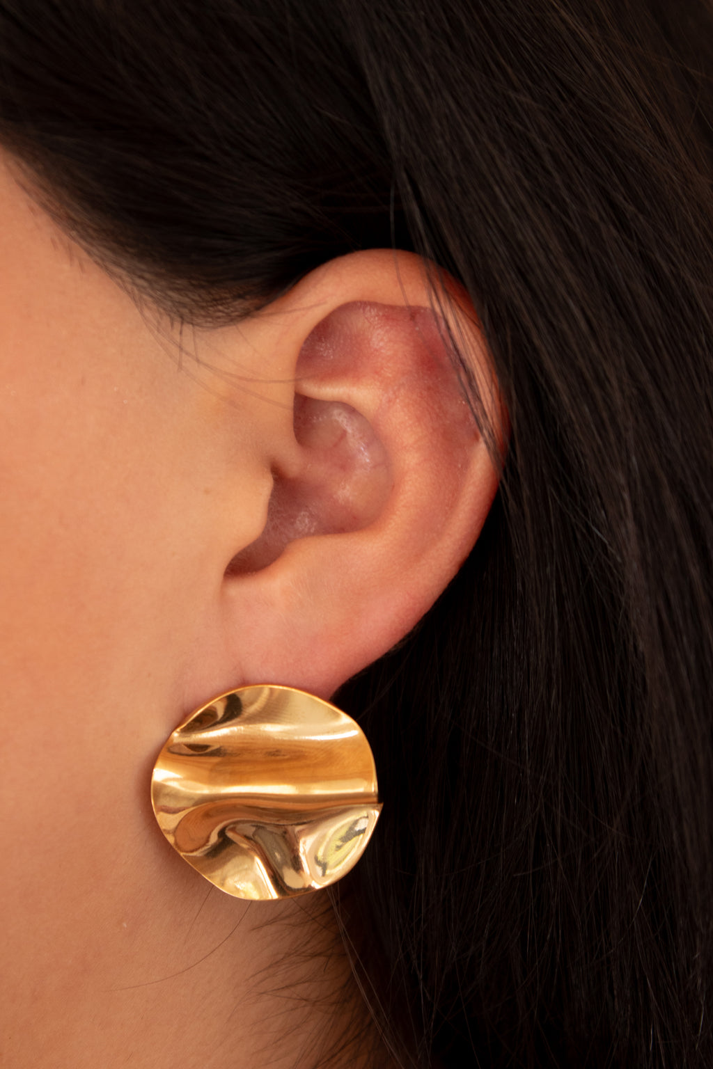 Aretes vertice
